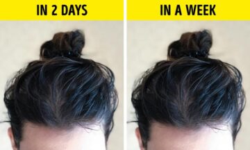 สาเหตุที่ทำให้ผมมัน วิธีแก้ปัญหาผมมันและการดูแลรักษา